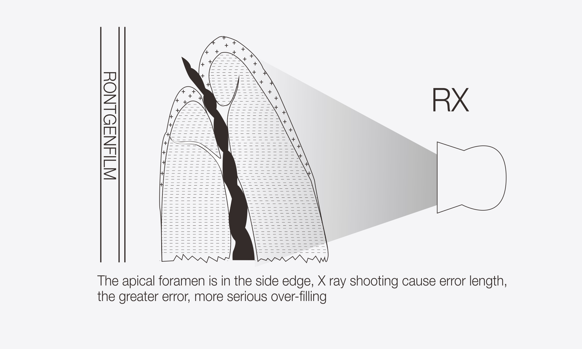 Disadvantage of X Ray Film
