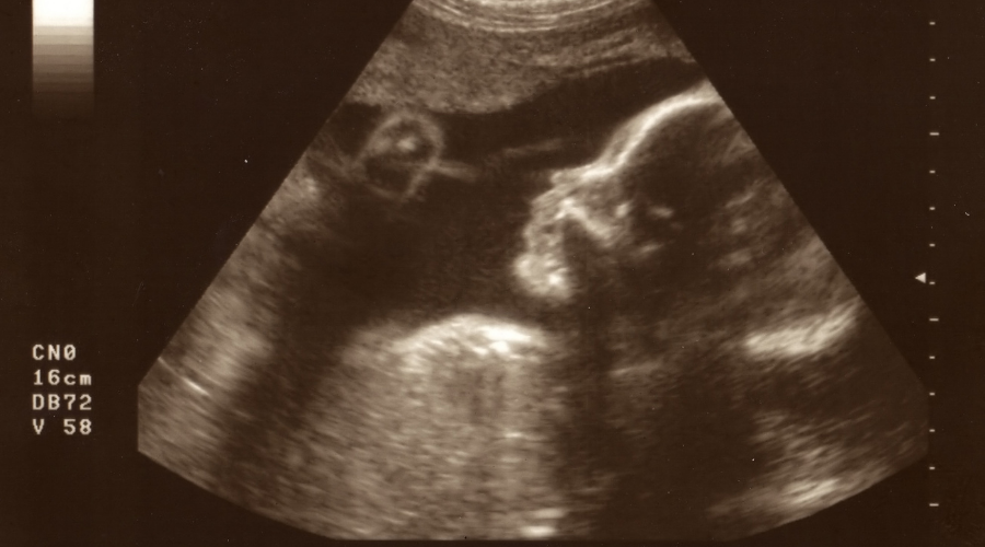 24 Haftalık Bebek Kaç Gram Olur?