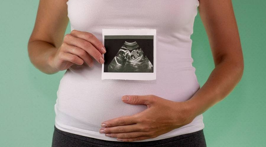 Kadın İlk trimester döneminde gebeliğin dördüncü haftasında ultrasonla tespit edilen ikizlerin fotoğrafını tutuyor.