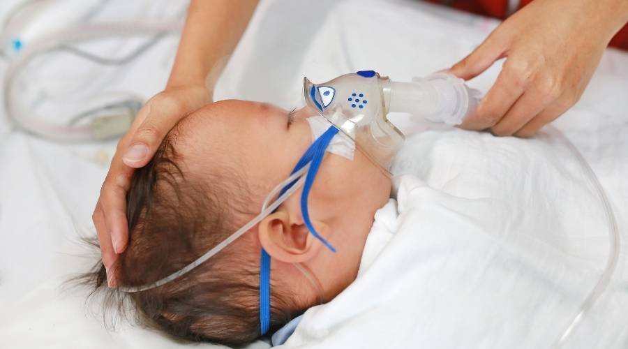 Küçük çocuk astım veya zatürre hastalığını tedavi etmek için nebülizatör kullanıyor Hasta bebek hastane yatağında yatıyor ve inhaler maskesiyle inhalasyon tedavisi görüyor rsv virüsü.