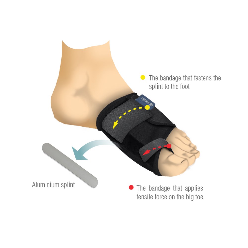 Aurafix Hallux Valgus Gece Ateli
