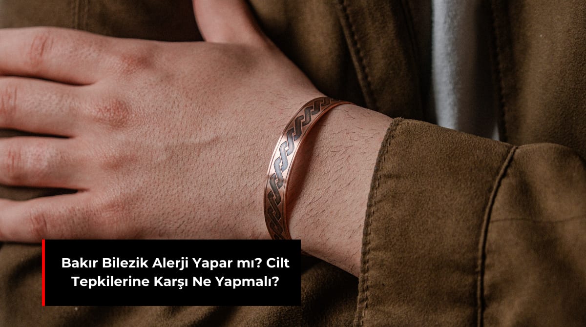 BAKIR BİLEZİK ALERJİ YAPAR MI? CİLT TEPKİLERİNE KARŞI NE YAPMALI?