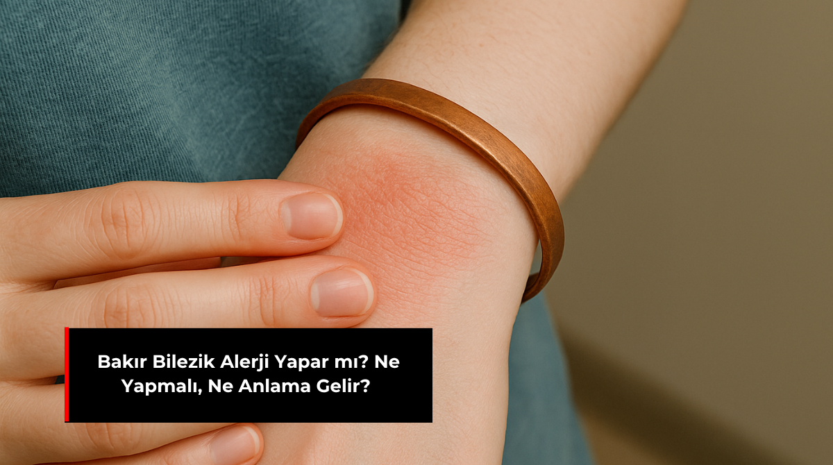 BAKIR BİLEZİK ALERJİ YAPAR MI? NE YAPMALI, NE ANLAMA GELİR?
