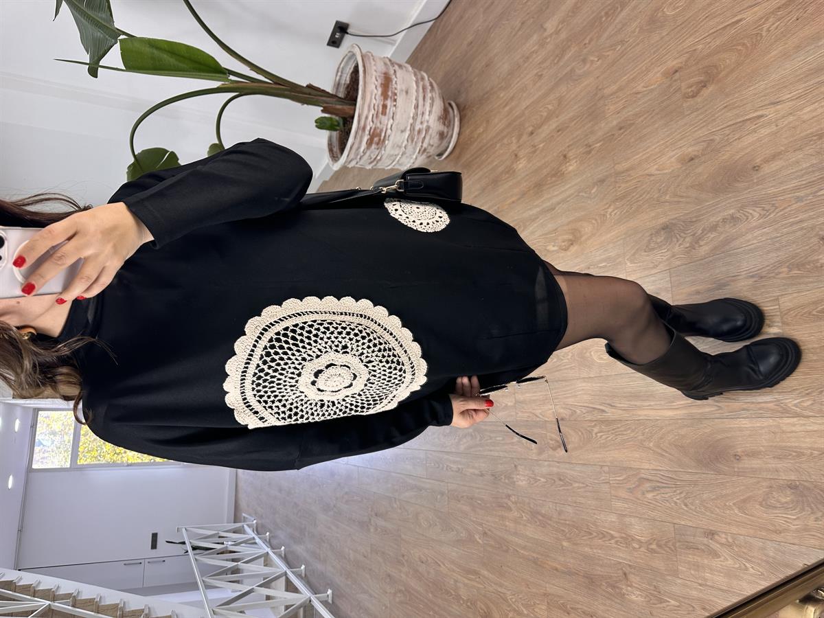 Dantel Detaylı Tunik Elbise-Siyah