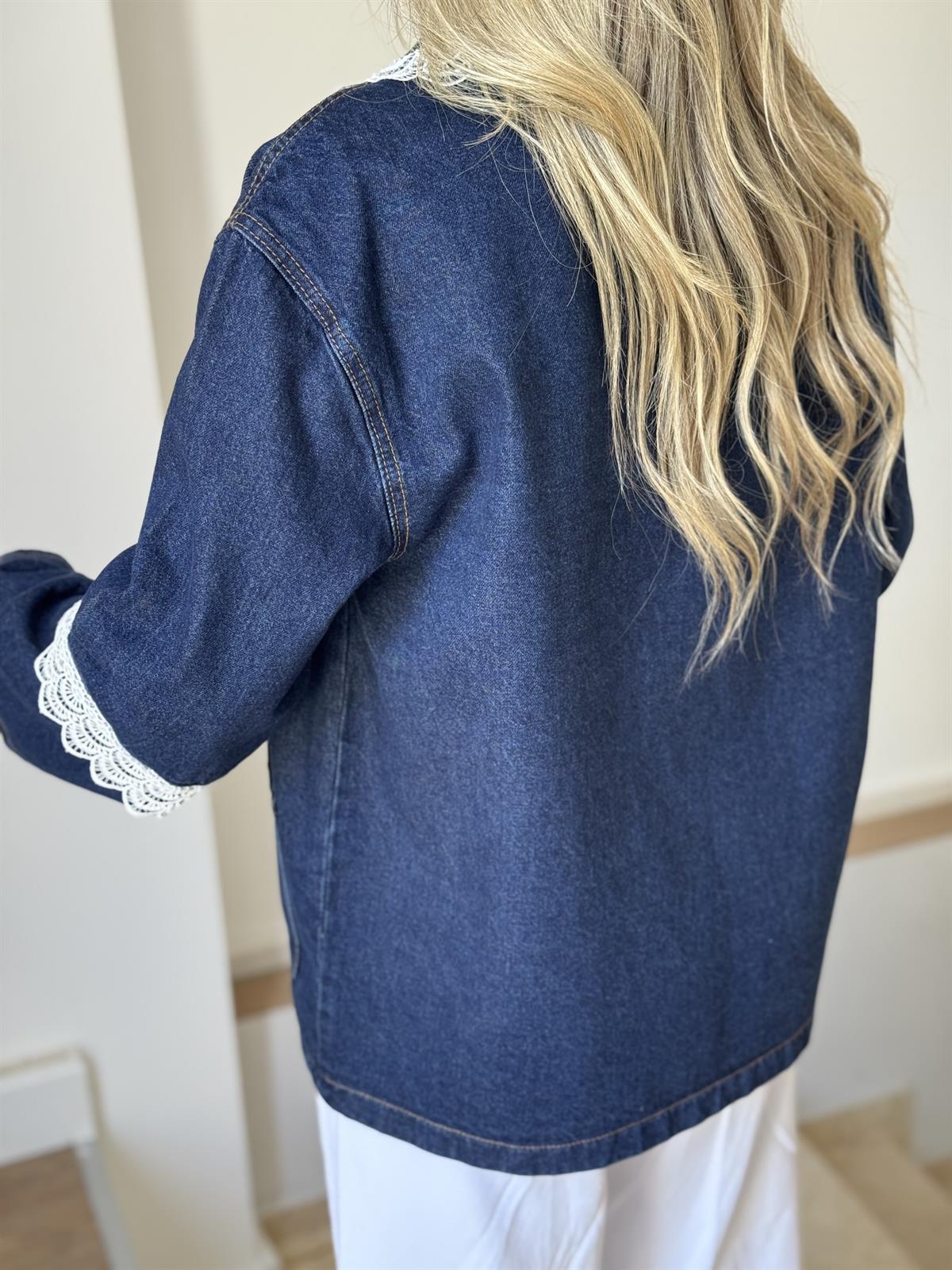 Dantel Detaylı Oversize Denim Ceket 