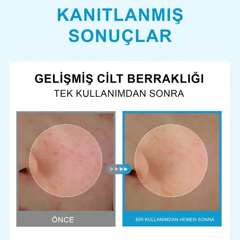Centellian24 Hyal Glow Gel Mask - Soğutucu Hydrojel Maske
