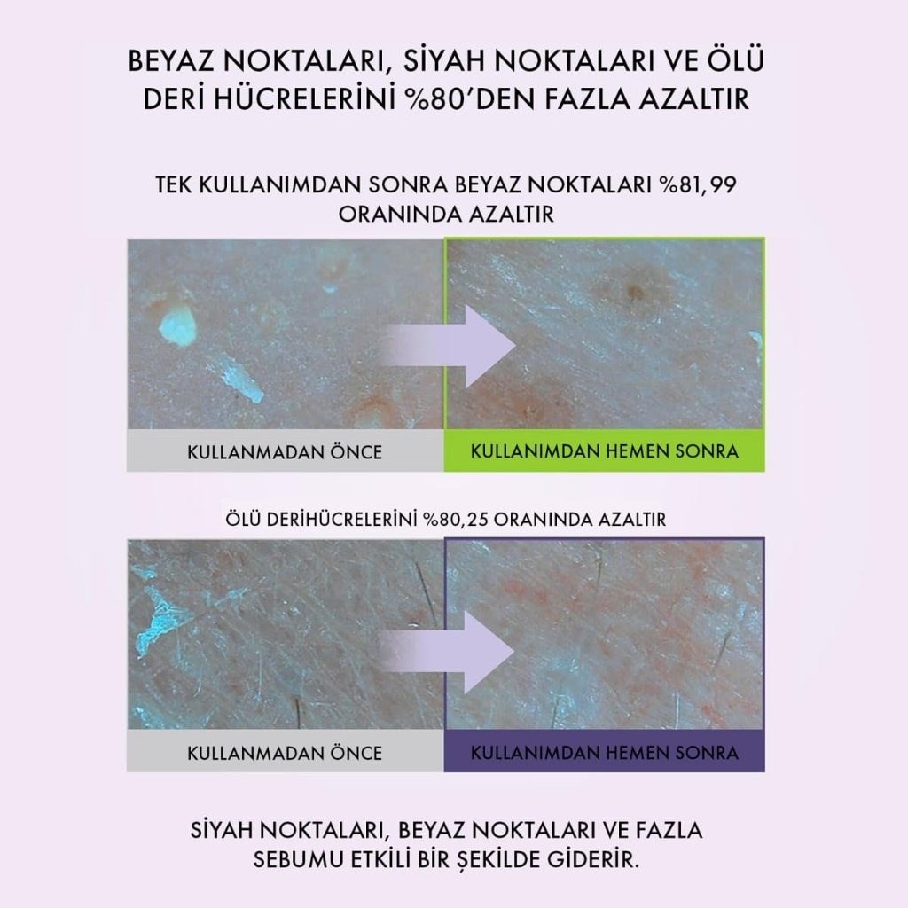 Centellian24 Real Green Pore Pad - 2'li Burun Bakım Seti