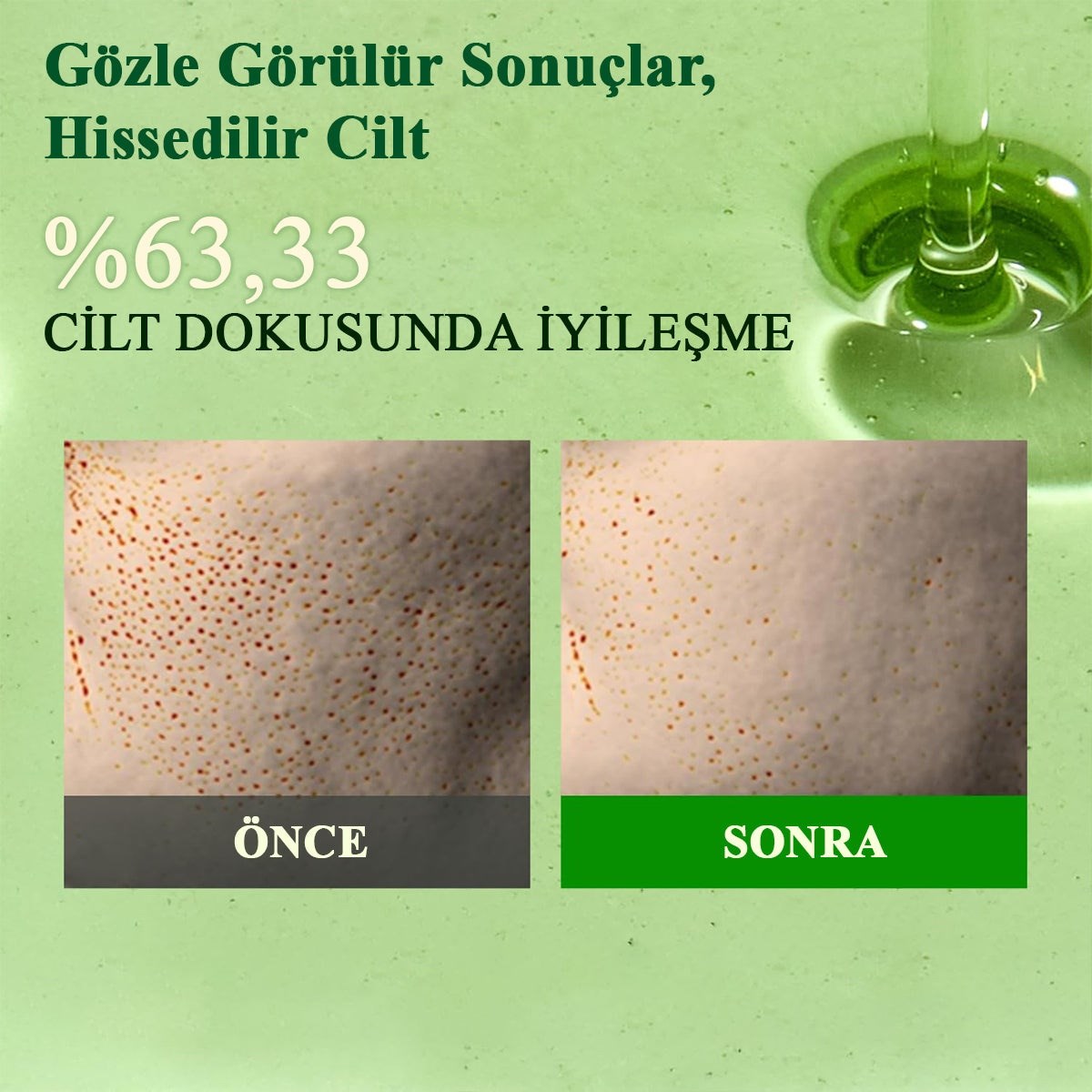 Fully Green Tomato Acid 20 Wash Off Peeling Serum - AHA BHA PHA Peeling Serumu