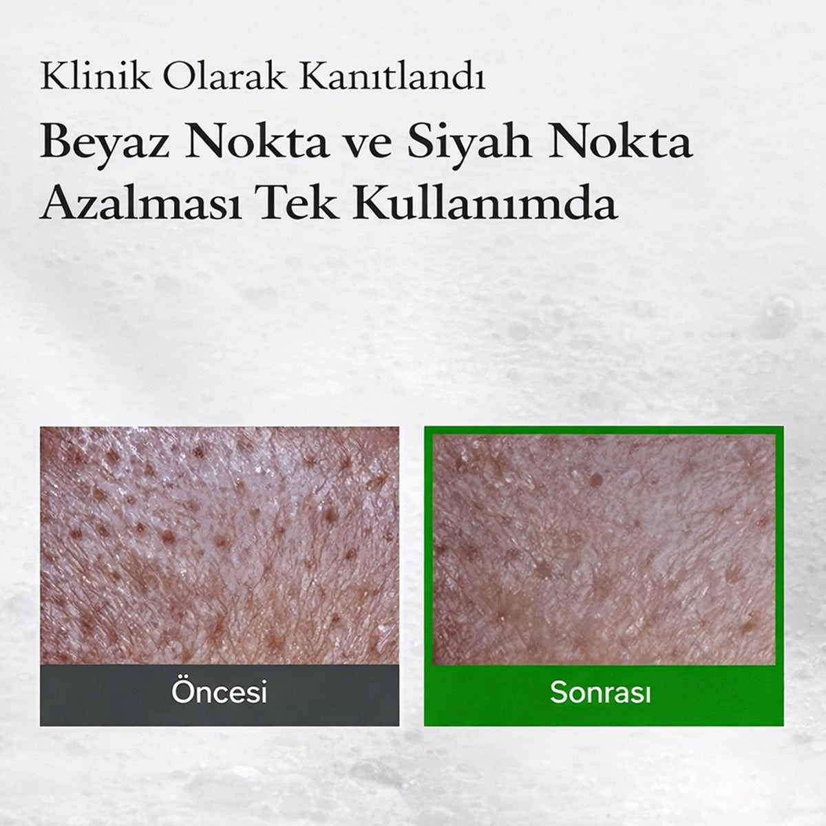 Fully Green Tomato Clay Mask Cleanser - Gözenek Arındırıcı Kil Temizleyici