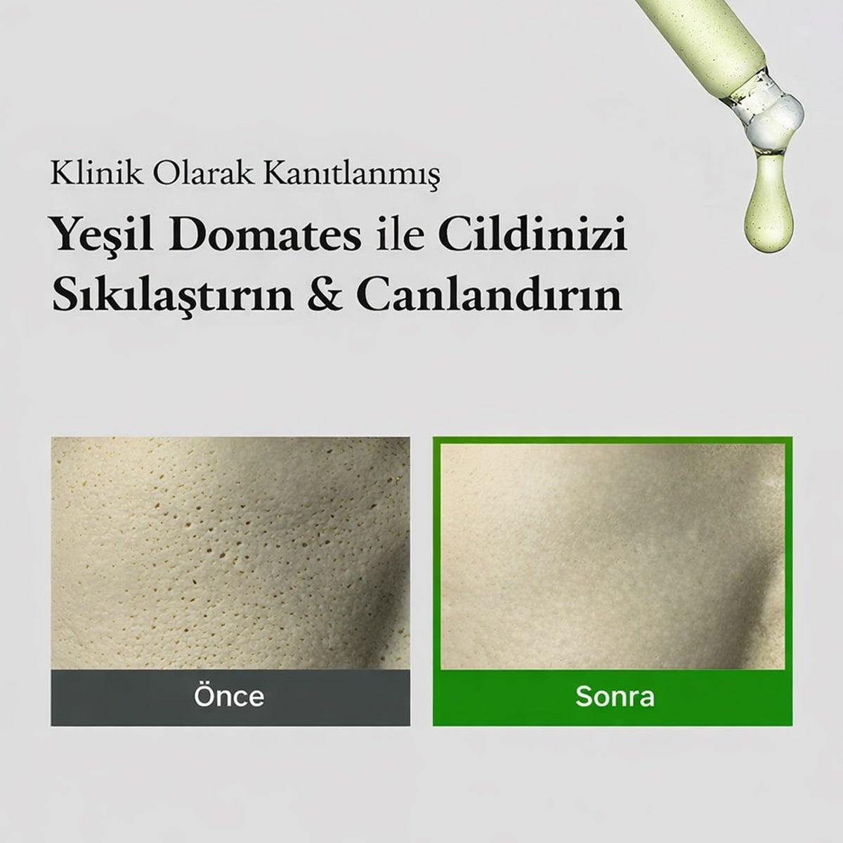 Fully Green Tomato Serum - Gözenek Arındırıcı Serum