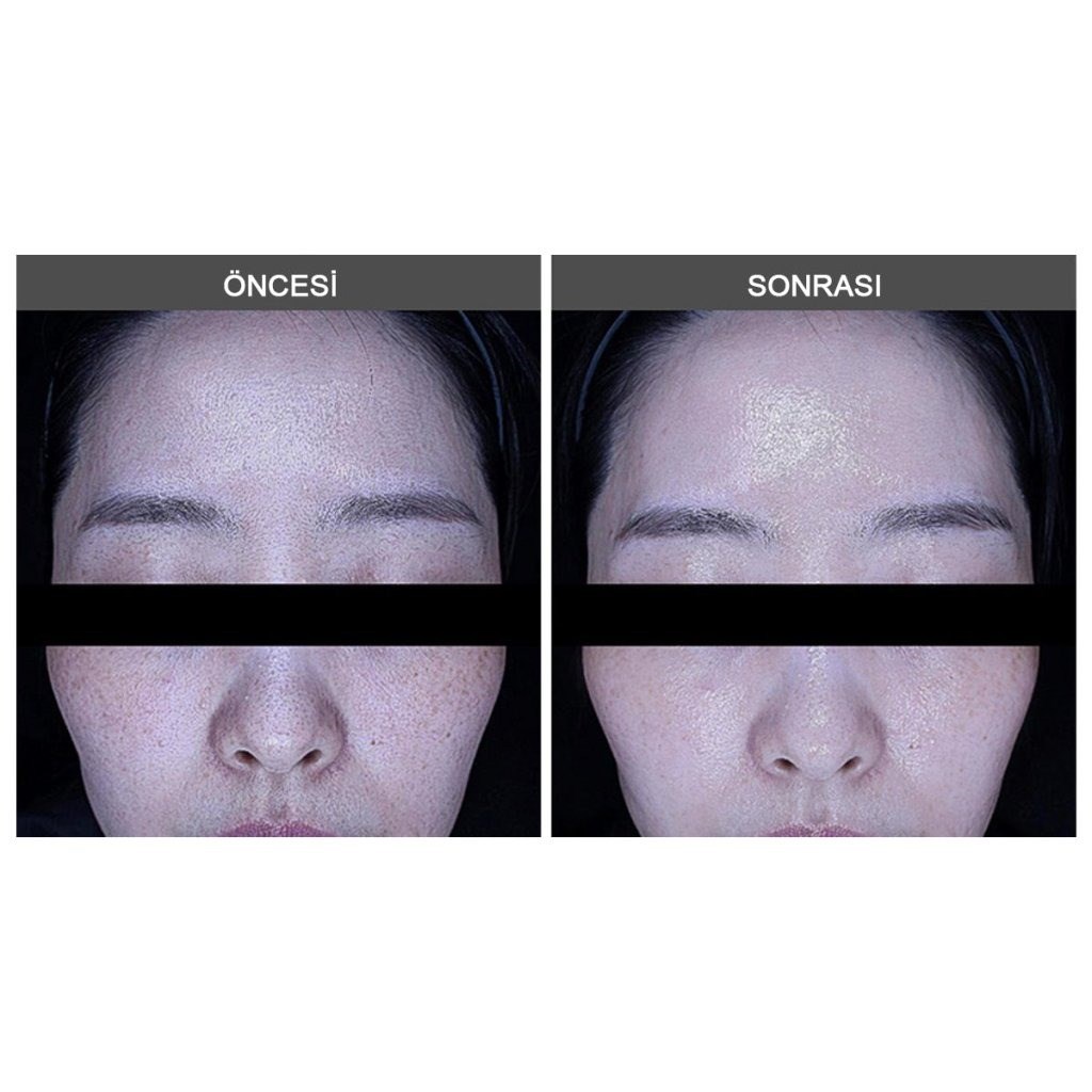 LamuCell Bio Retinol Essence 100 - Hassas Retinol 50 ml
