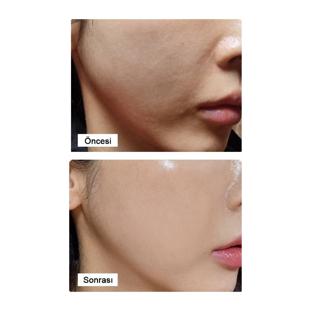LamuCell PDRN Ampoule - Kırışıklık Karşıtı PDRN Serum 50 ml