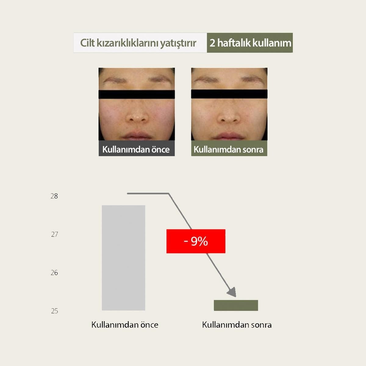 Mary & May Sensitive Soothing Gel Cream - Yatıştırıcı Krem 70 g