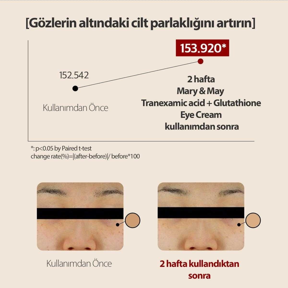 Mary & May Tranexamic Acid Eye Cream - Aydınlatıcı Göz Kremi 30 g