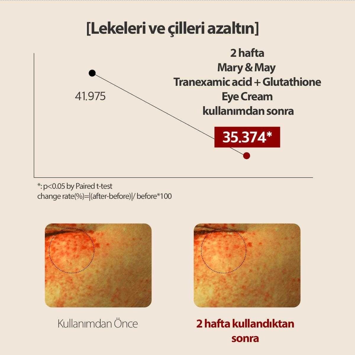 Mary & May Tranexamic Acid Eye Cream - Aydınlatıcı Göz Kremi 30 g