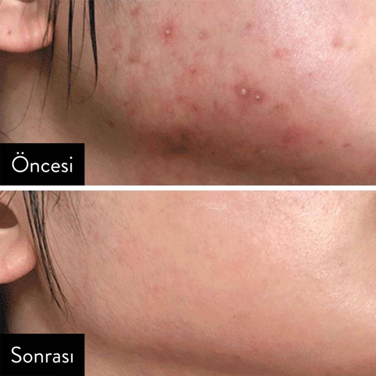 Some by MI AHA - BHA - PHA 30 Days Miracle Toner 150 ml