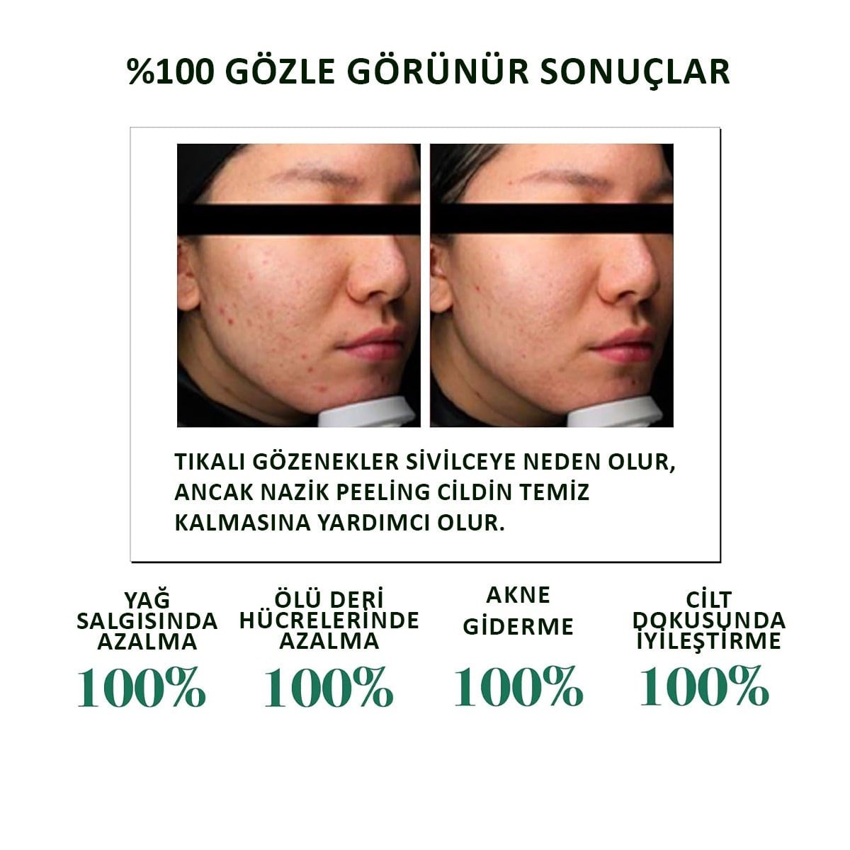 Some by MI AHA - BHA - PHA 30 Days Miracle Toner 150 ml