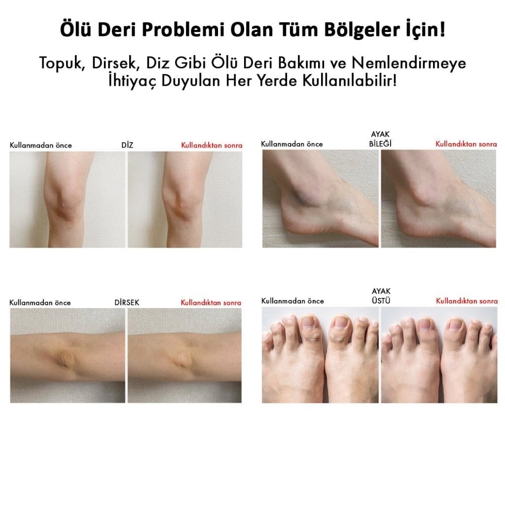 Sungboon Editor Cracked Heel Stick - Yoğun Topuk Bakım Sticki