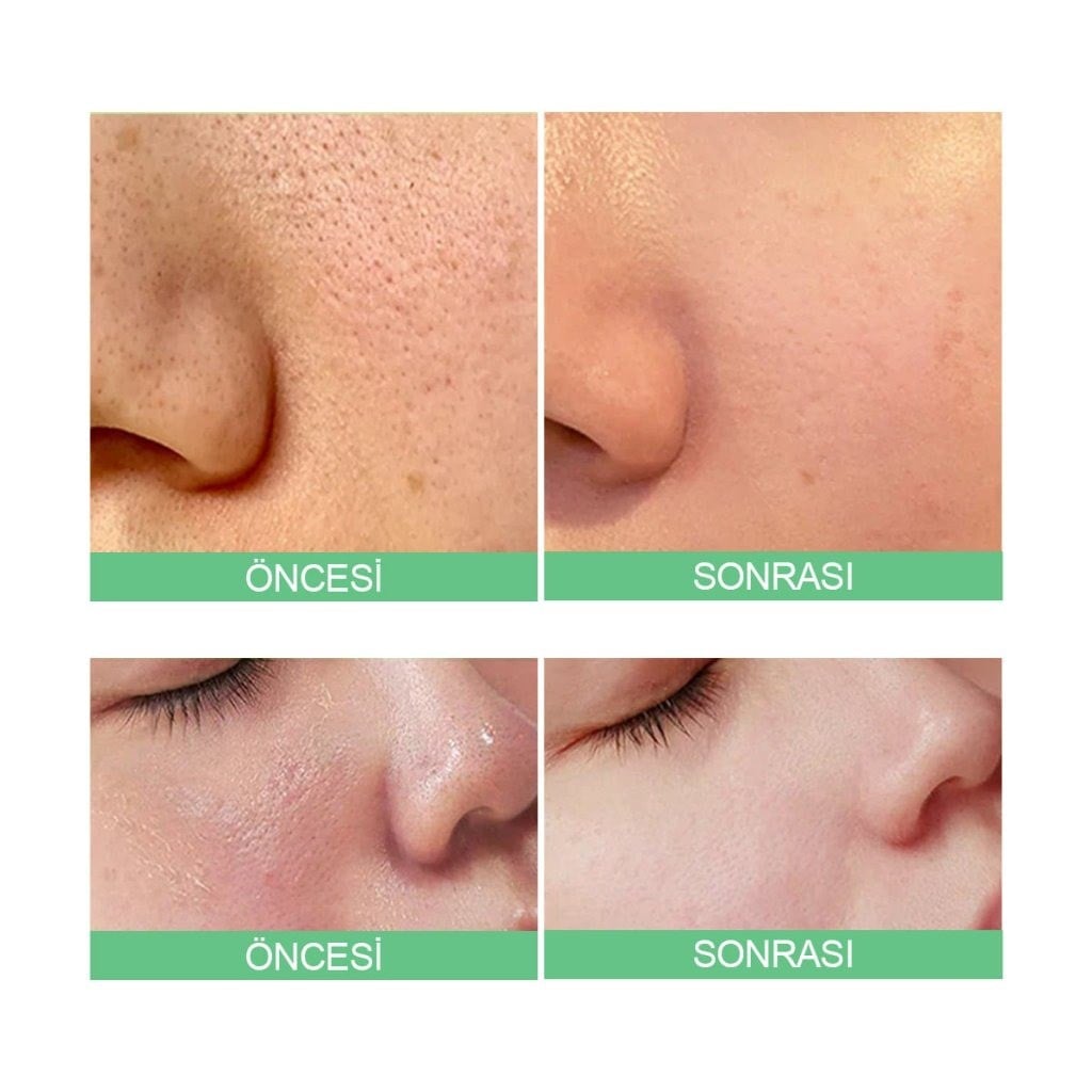 Sungboon Editor Tomato Lifting Ampoule - Sıkılaştırıcı Serum 30 ml