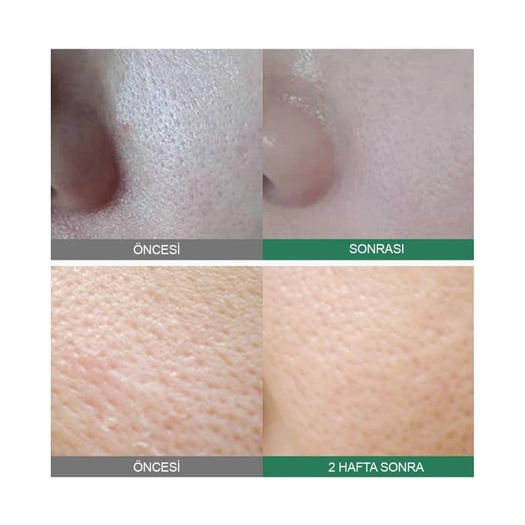 Sungboon Editor Tomato Tight Toner - Gözenek Sıkılaştırıcı Ampul Tonik 350 ml