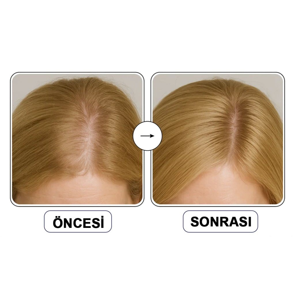 ViveLab Spioxyl Shot 800 - Güçlü Saç Derisi Ampülü