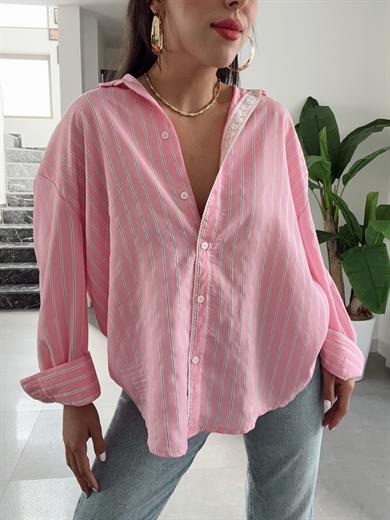Pembe Dantel Detaylı Çizgili Gömlek