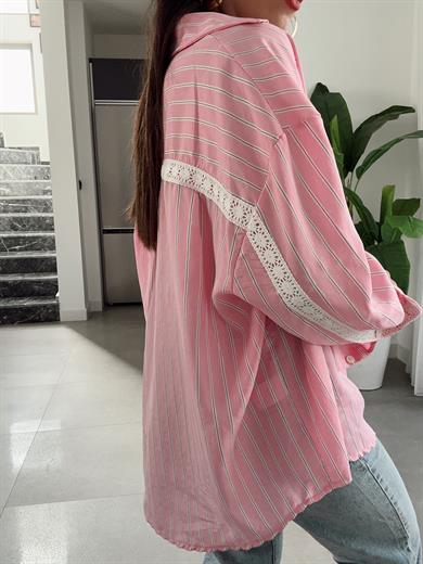 Pembe Dantel Detaylı Çizgili Gömlek