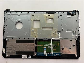 Orijinal Sorunsuz Hp 15-r215nt (L0F30EA), 15-r216nt (L0F33EA) Notebook Üst Kasa Stok: Z100