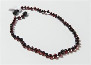 Babyjem Kehribar Bebek Kolyesi Vişne 587