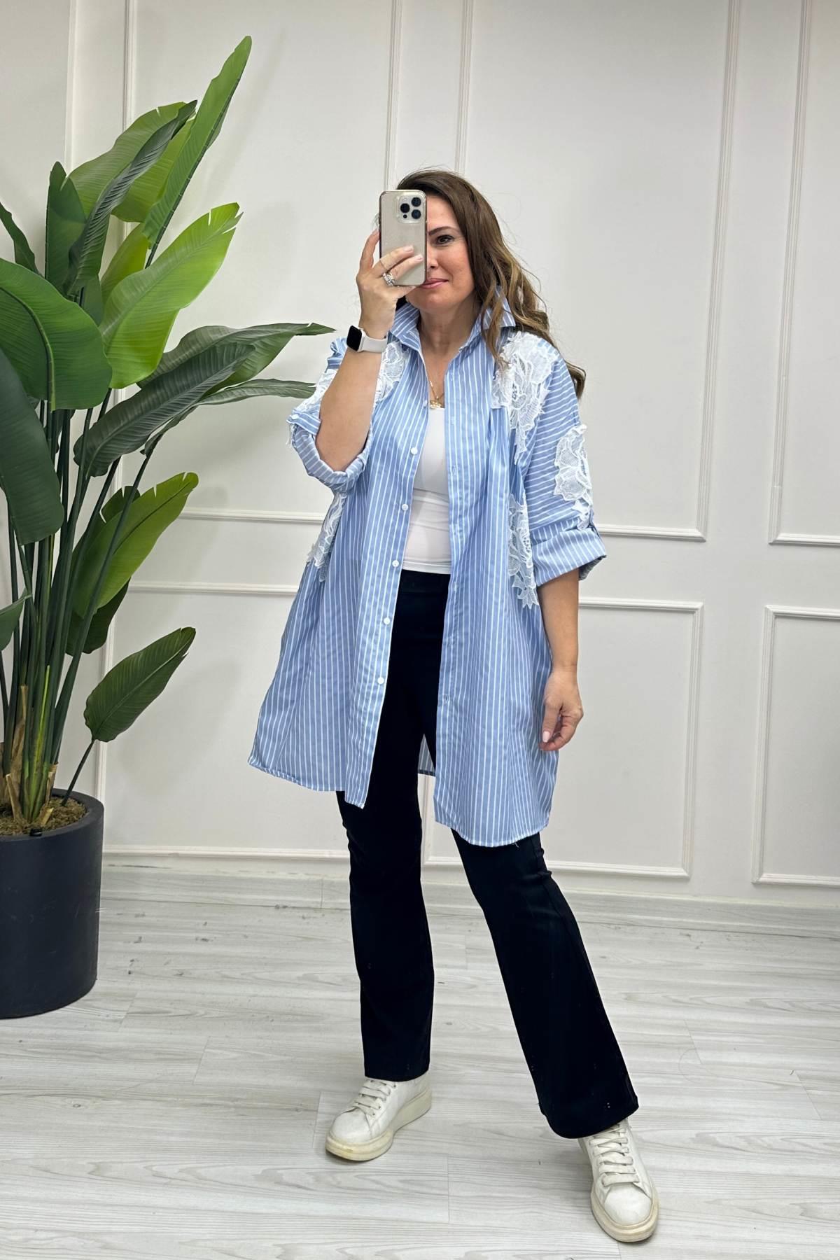 Oversize Motif Detaylı Çizgili Gömlek Mavi