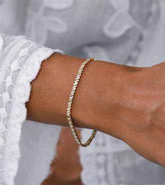 Eğik Dizilim Çubuk Bileklik