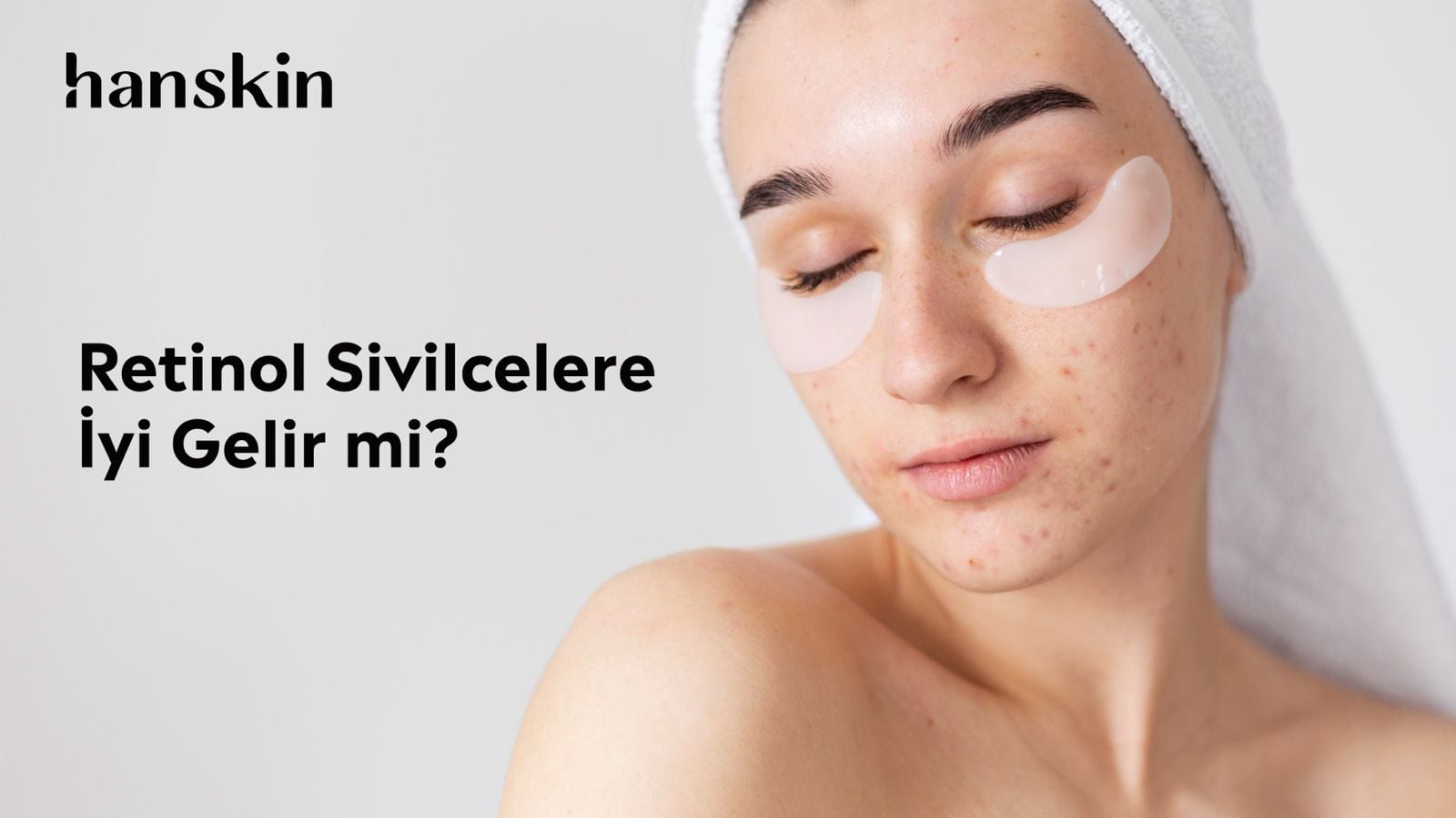 Retinol Nedir? Retinol Sivilcelere İyi Gelir mi? Nasıl ve Ne Zaman Kullanılmalı?