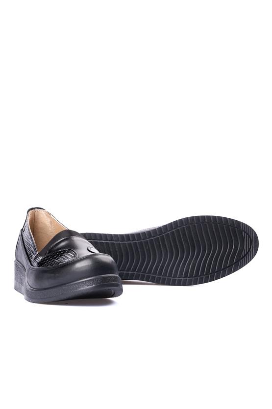Edik 144Lp Siyah Kadın Comfort Ayakkabı