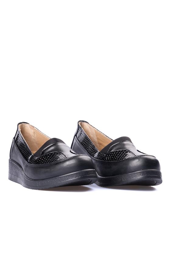 Edik 144Lp Siyah Kadın Comfort Ayakkabı