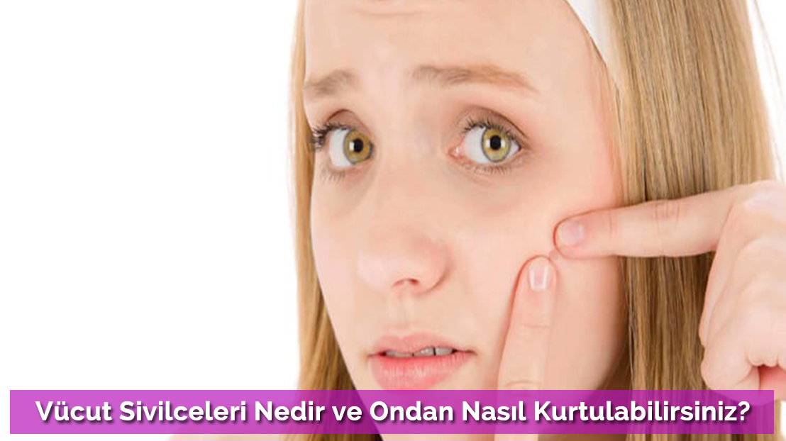 What is Body Acne and How Can You Get Rid of It?