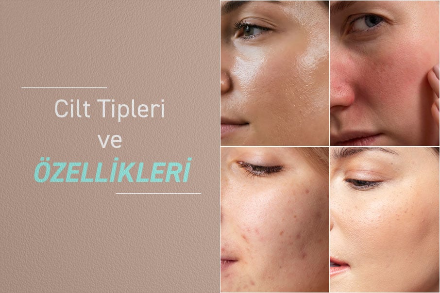 Cilt Tipleri Nelerdir ve Kaç Cilt Tipi Vardır?