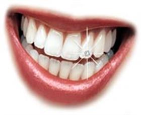 105 Adet Kristal Diş Taşı
