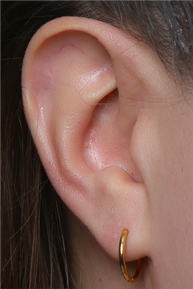 Düz Küpe (İnce) Orta Boy Gold Piercing