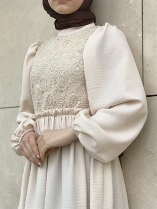 Balon Kol Beli Lastikli Güpür Detay Elbise Taş