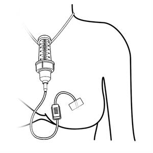 Eday e.d.s. Emzirme Destek Sistemi 60ml