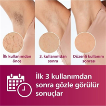 Philips Lumea  BRI921/00 Lazer Epilasyon IPL Tüy Alma Cihazı+Kaş Düzeltici,Yüz+Vücut+Hassas Bölge Kullanımı