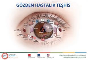 Göz Hastalık Teşhis Noktaları Posteri
