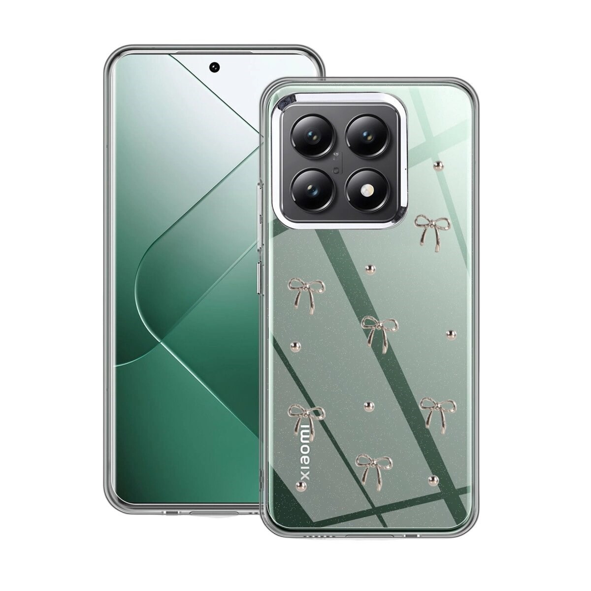 Xiaomi Mi 14t Pro Fiyonk Desenli Kapak - Desen 5