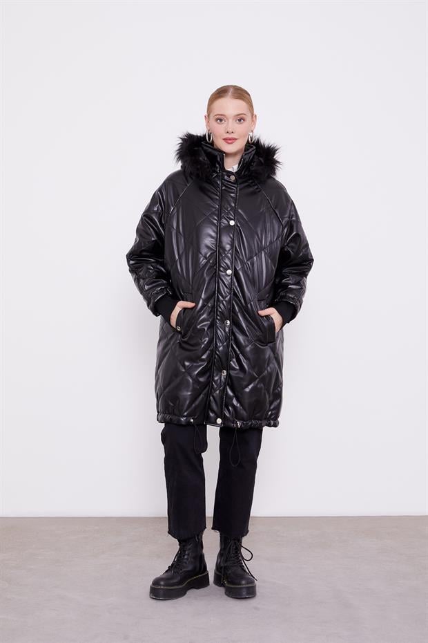 Siyah Kapitone Kapüşonlu Mont