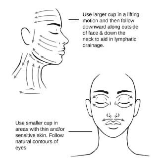 abrizon tekniği , yüz hacamatı