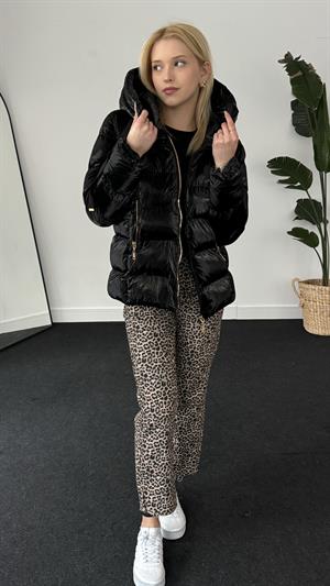 Parlak Kapüşonlu Gold Detay Mont Siyah