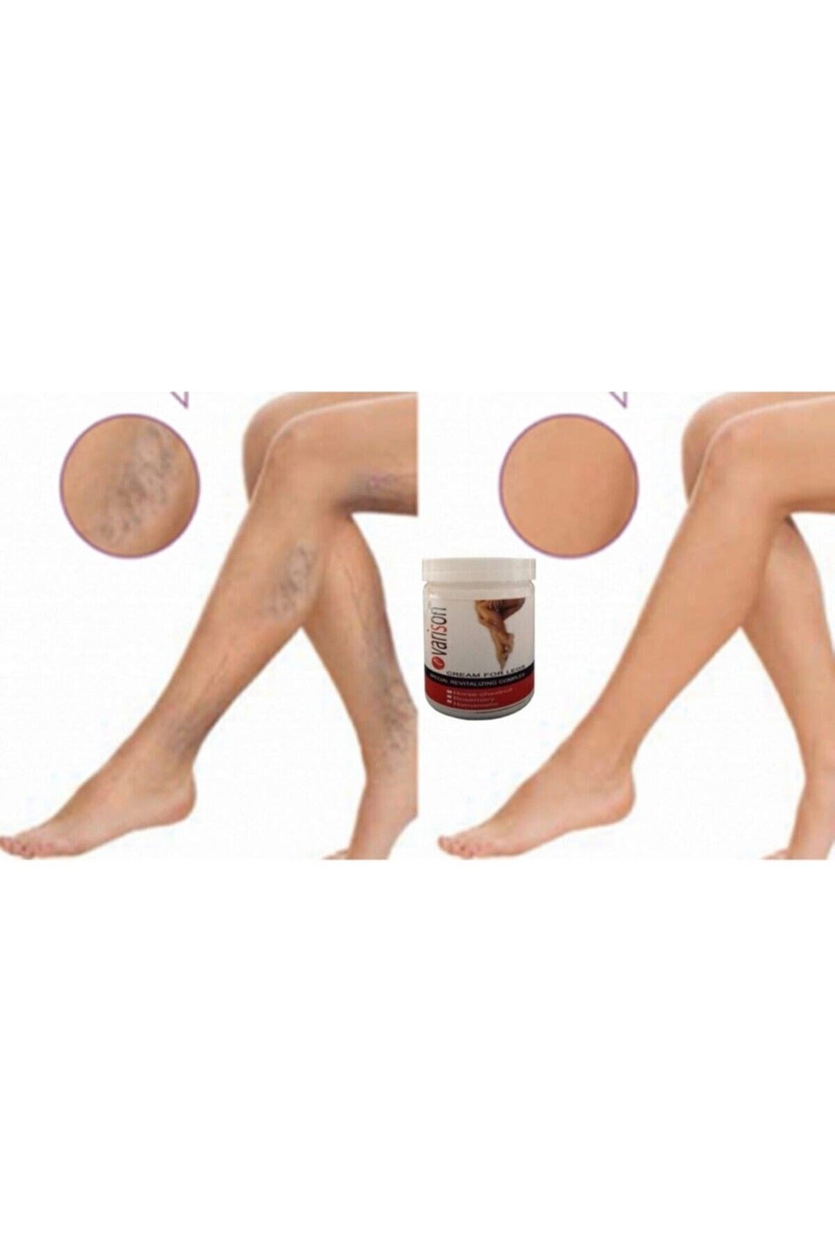On  Selüllit Bacak Bakım Kremi 200 ml X 2adet