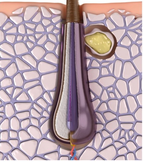 Anajen büyüme evresi saç kökü görseli