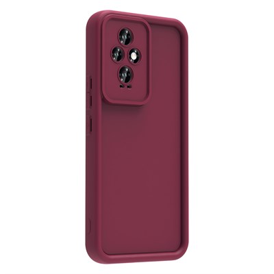 Honor 200 Kılıf Kamera Korumalı Zore Ananas Kapak