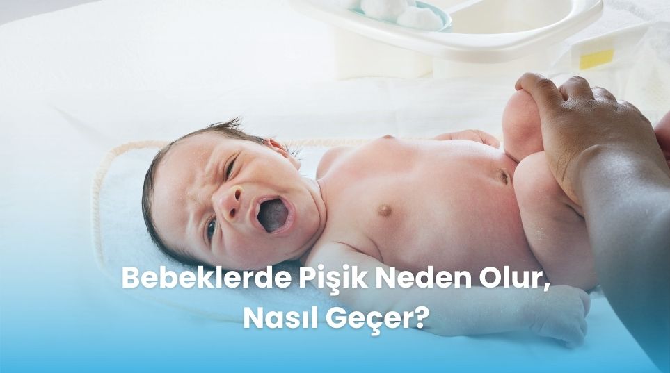 Bebeklerde Pişik Neden Olur, Nasıl Geçer?